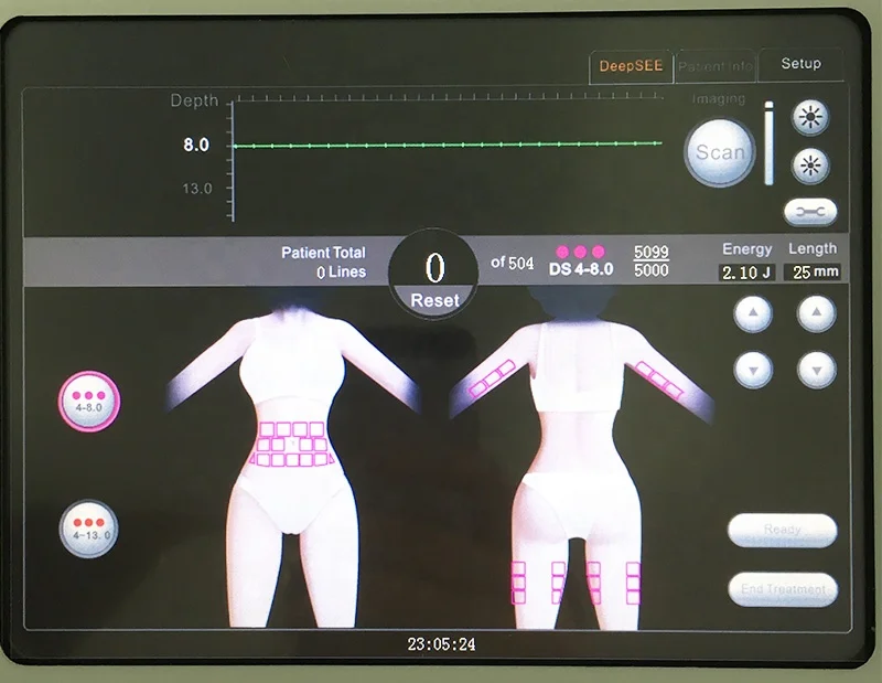 2020 discount mini hifu face lift machine for skin tightening wrinkle removal