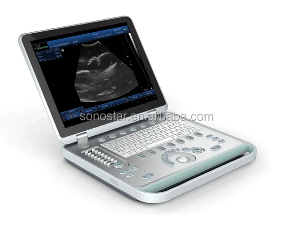 
3D 4D laptop ultrasound machine for pregnancy SS-9 Model 
