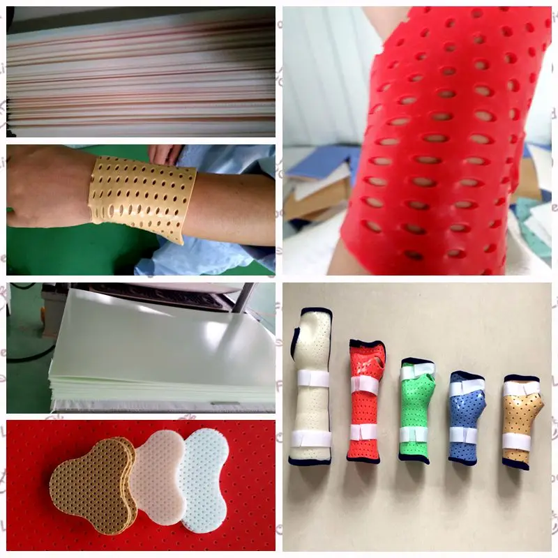 Термопластичные шины, используемые для перелома локтевого пальца