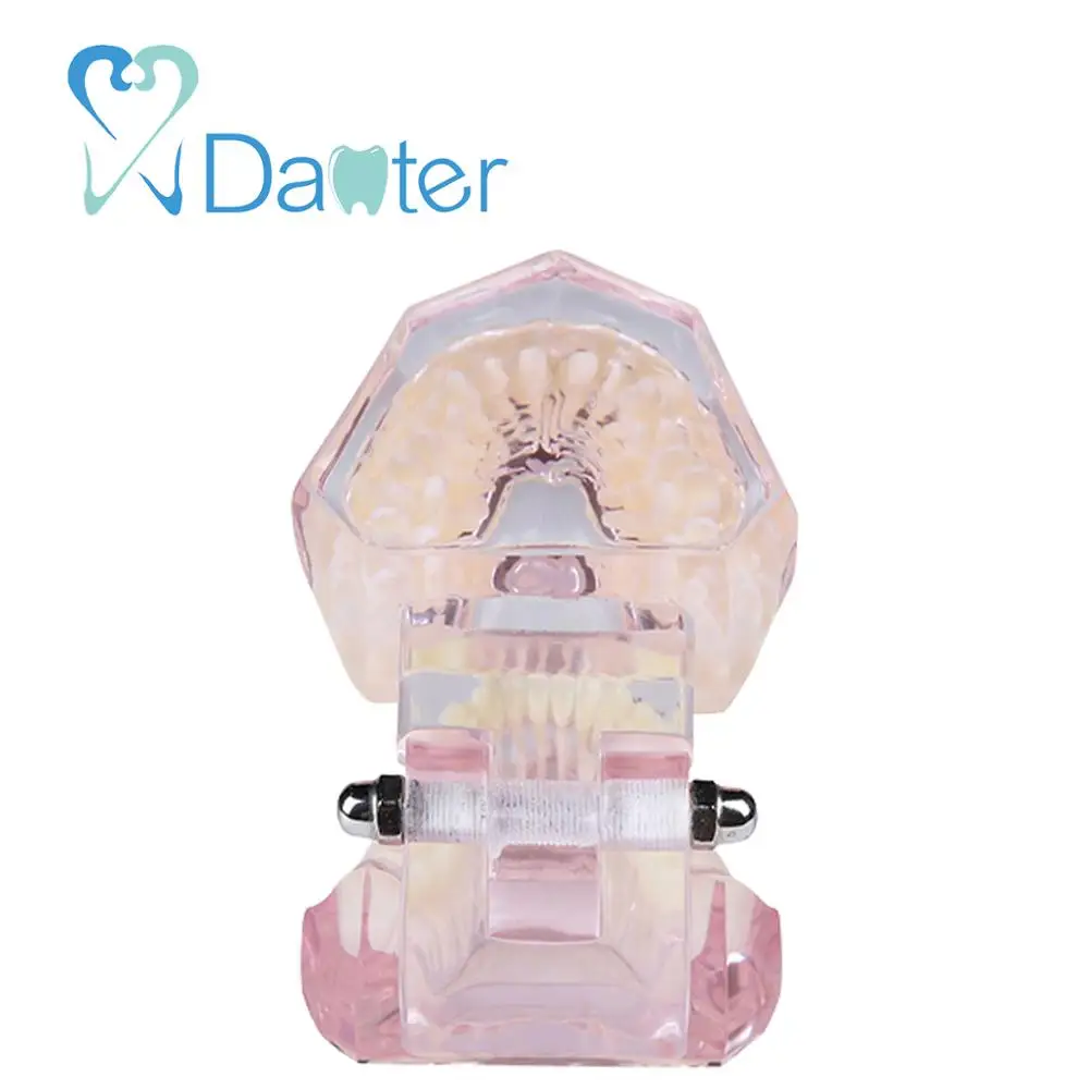 New Arrival Dental Orthodontic Model with Metal and Ceramic Bracket