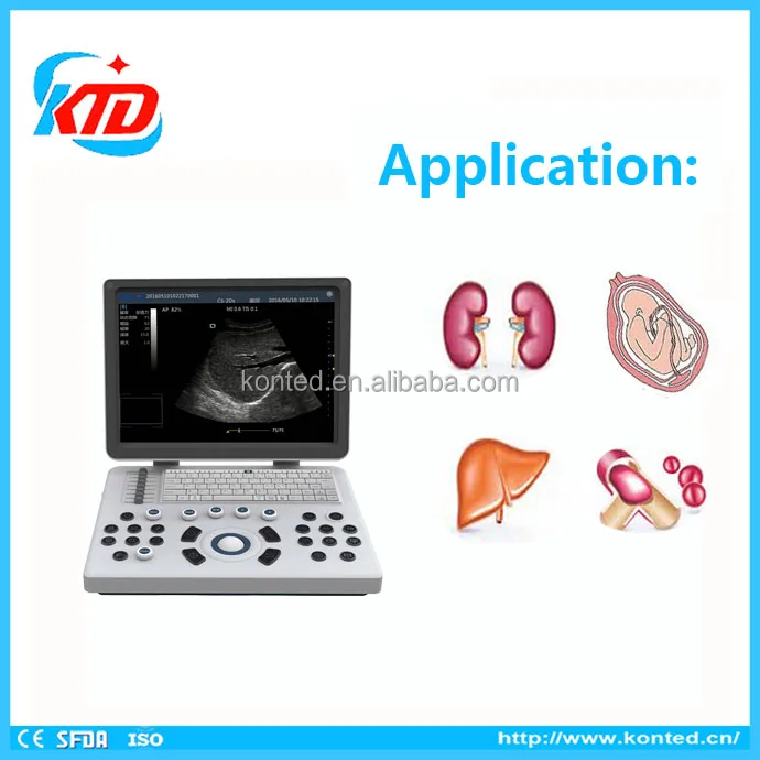 Echocardiograph Machine Portable B Ultrasound Scanner For Sale In Beijing