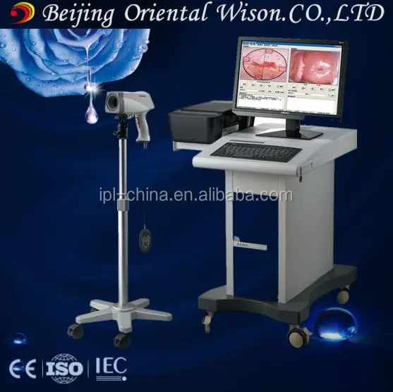 Gynecology examination 1080p hd video vaginal colposcope for clinic