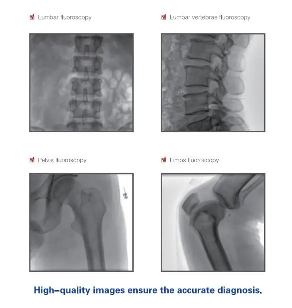 BT-XC06 Grayscale LCD display 9' Dynamic Flat Panel Detector surgical orthopedic c-arm radiation exposure equipment c arm x-ray