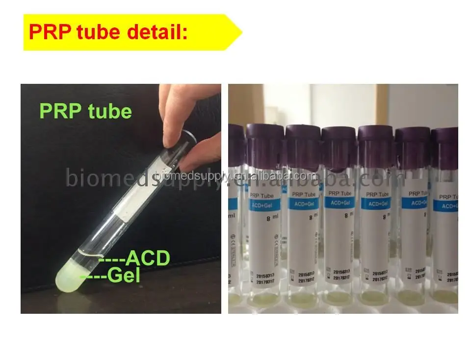 BEMEDIKPRP CE Certified 15ml prp tube with sodium citrate with gel sodium citrate