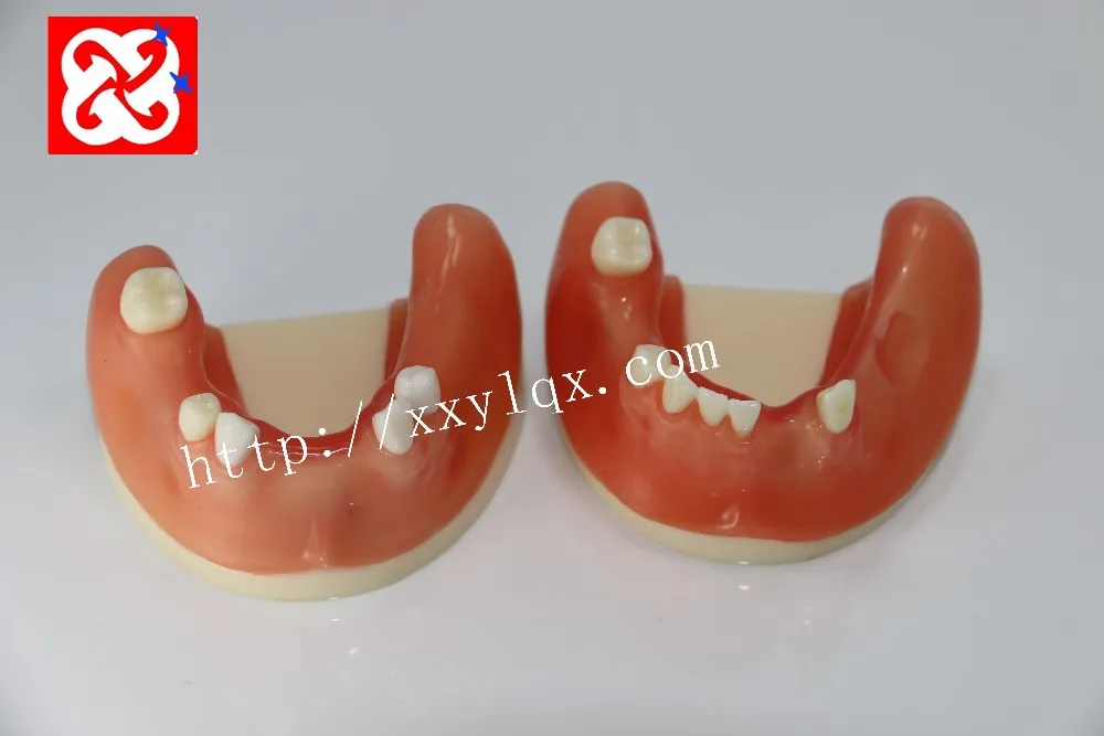 implant practice denta model for cutting, suturing in different teeth missing lower half
