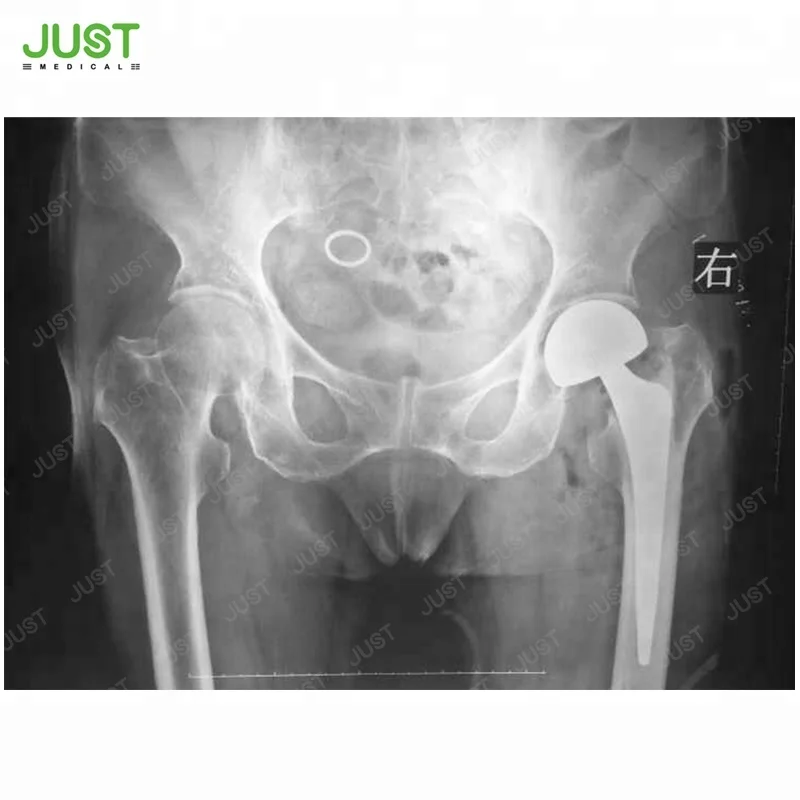 
TAICH cemented femoral stem Hip Joint Replacement Prosthesis 