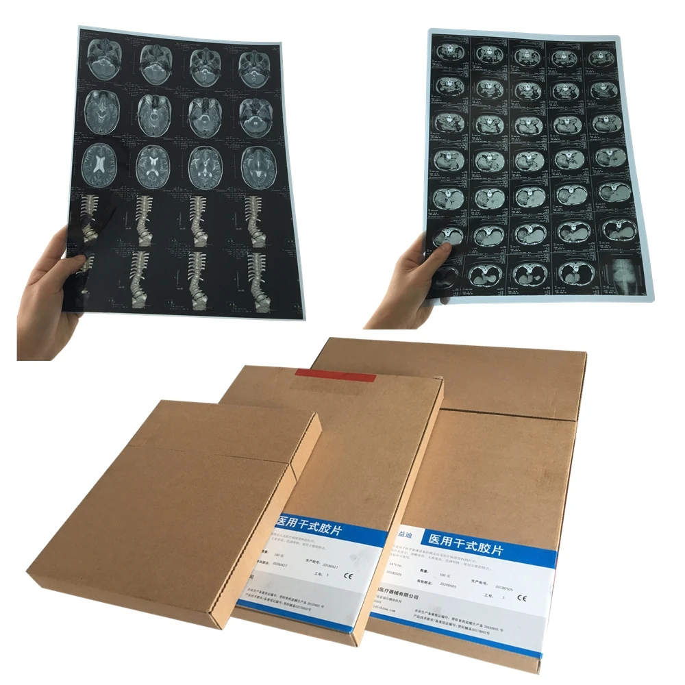 China Inkjet Printing Medical Imaging Film/Agfa Medical Thermal Films