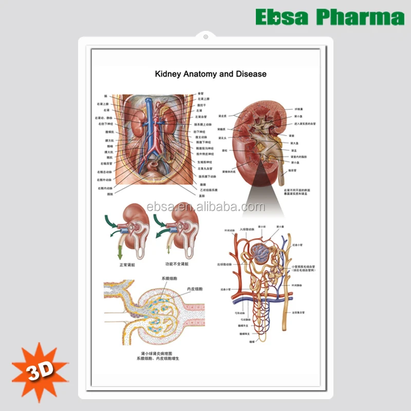 3D Medical Human Anatomy Wall Charts / Poster - Kidney Anatomy and Disease