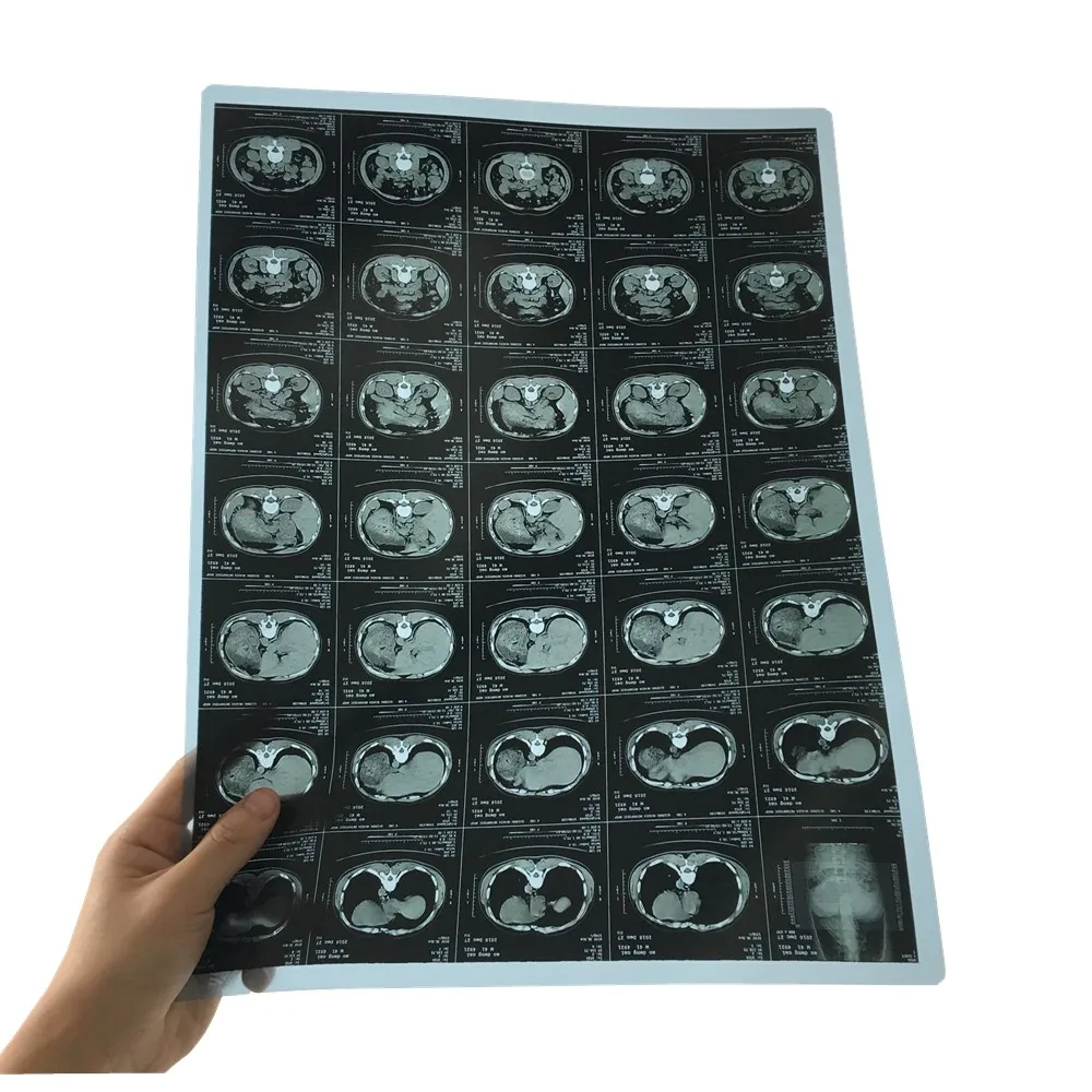 Thermal medical X-ray film for mri/cr/ct scan