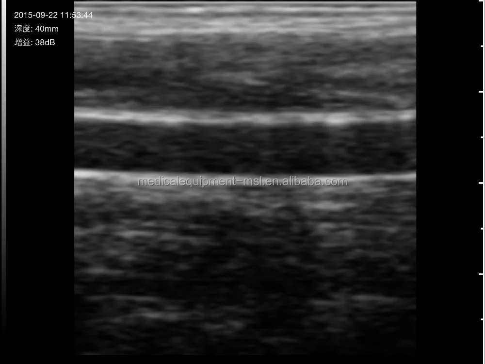 Большая Акция, недорогой беспроводной линейный зонд, ультразвуковой аппарат, портативный сканер MSLPU35/41/42
