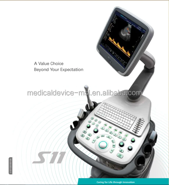 Ультразвуковой цветной допплер-сканер Sonoscape S11 с высоким разрешением echo