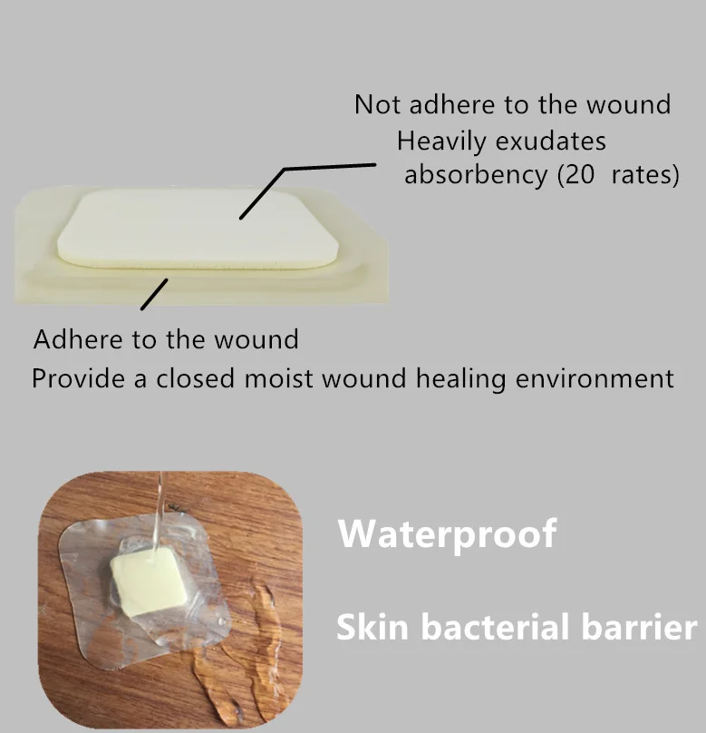 Medical Hydrocolloid Foam Pad Wound Dressing Safety Features Ultrasonic Disinfecting for Wound Care