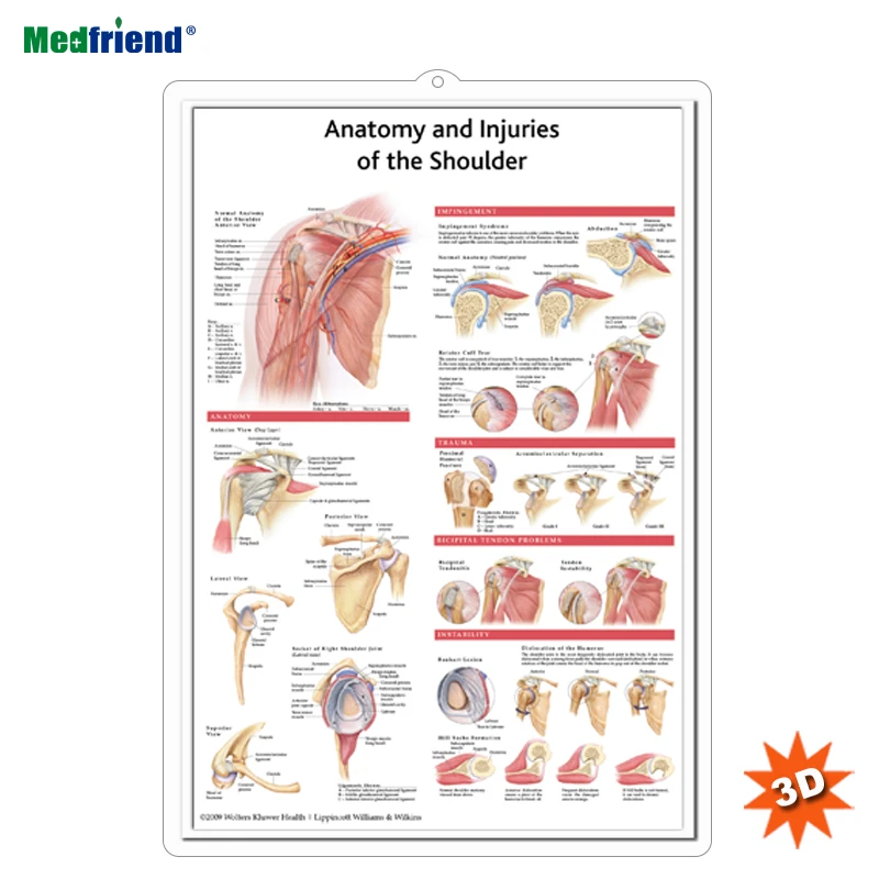 Educational Plastic 3D Anatomy Poster   - Anatomy and Injuries of the Shoulder
