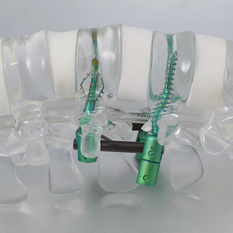 
Head fixation ring II External fixator device 