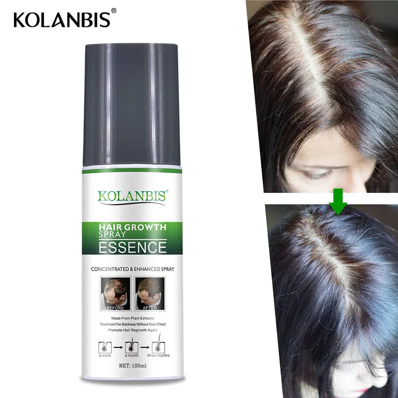 100 ML Hot selling whole sales hair growth serum for female and male