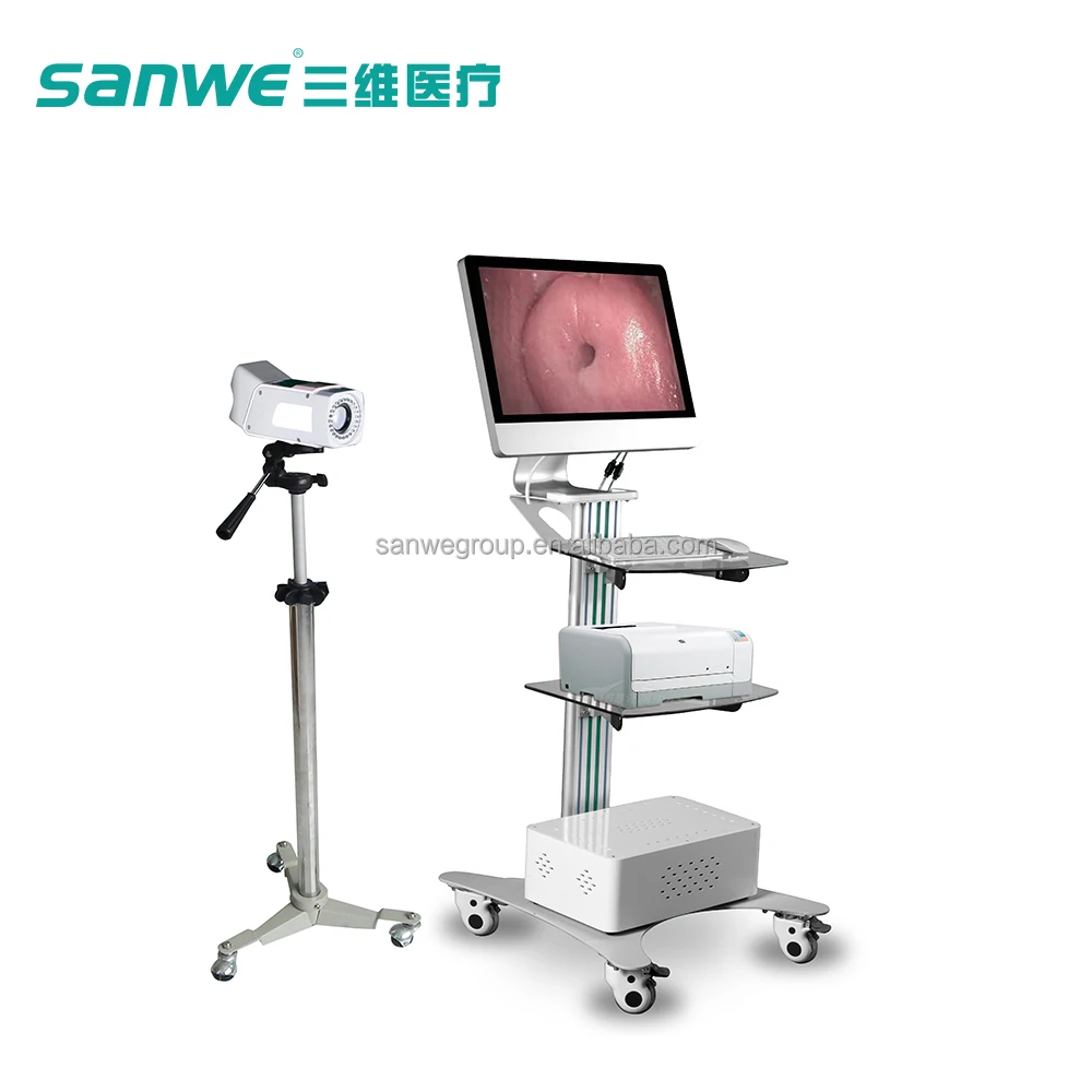 SW-3304 alibaba Китай электронные кольпоскопы