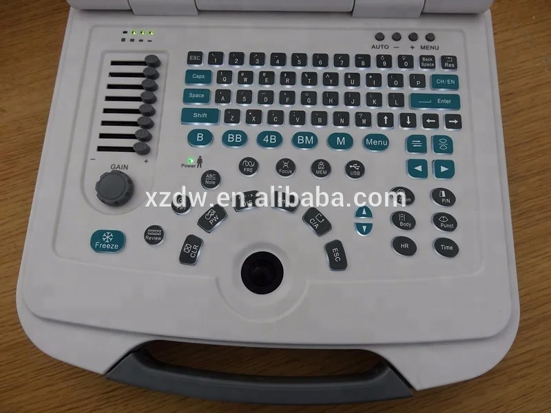 laptop ultrasound machine& cheap BW ultrasound scanner with battery DW580