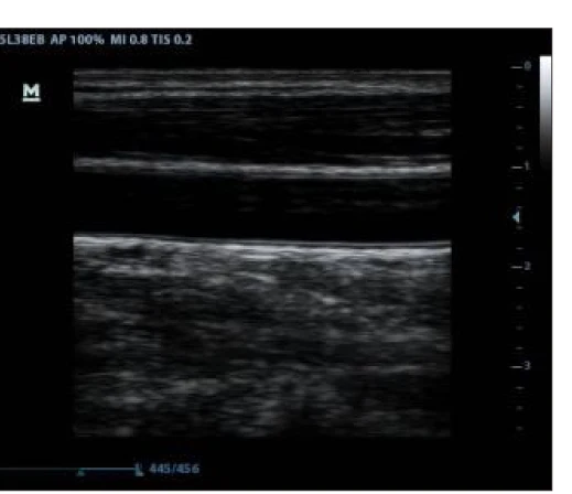 
Mindray dp 30 probe ultrasound/mindray veterinary ultrasound 
