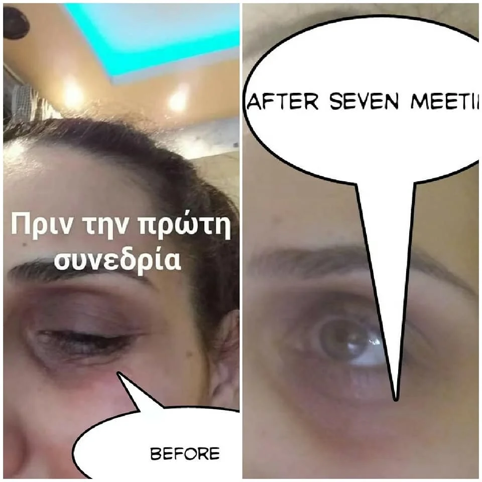 opt rf nd yag laser hair removal machine 4 in 1 multifunctional beauty esthetician equipment picosecond laser yag tattoo removal