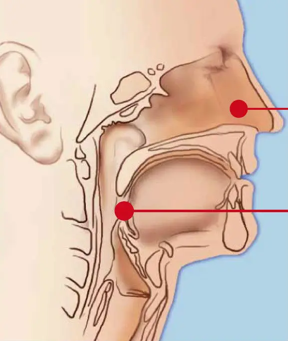 Diode Laser Scalpel for Nasal Sinus Polypectomy