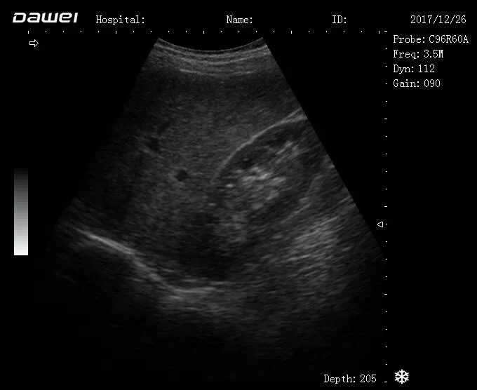 laptop ultrasound machine& cheap BW ultrasound scanner with battery DW580