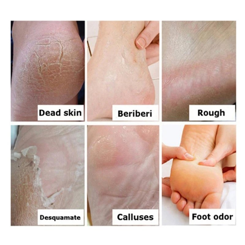Лидер продаж крем для ног с конским маслом треснувшей огрубевшей и сухой кожи частная торговая