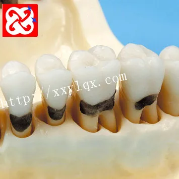 Periodontal disease model for practice cutting suturing