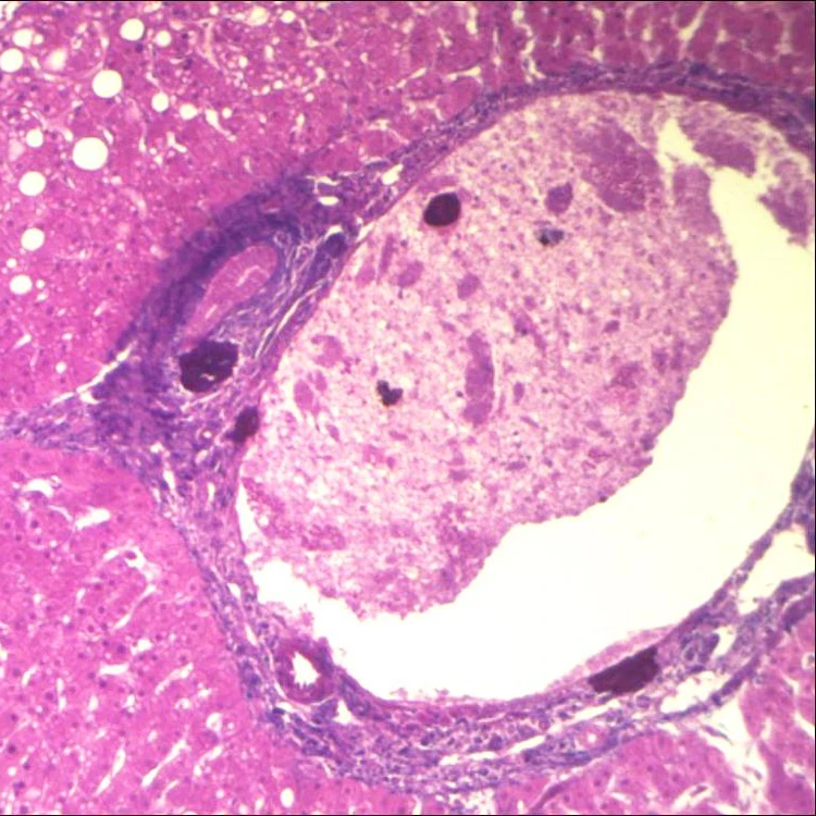 Fixed set High quality 50/100 pieces human general pathology prepared general pathology slides