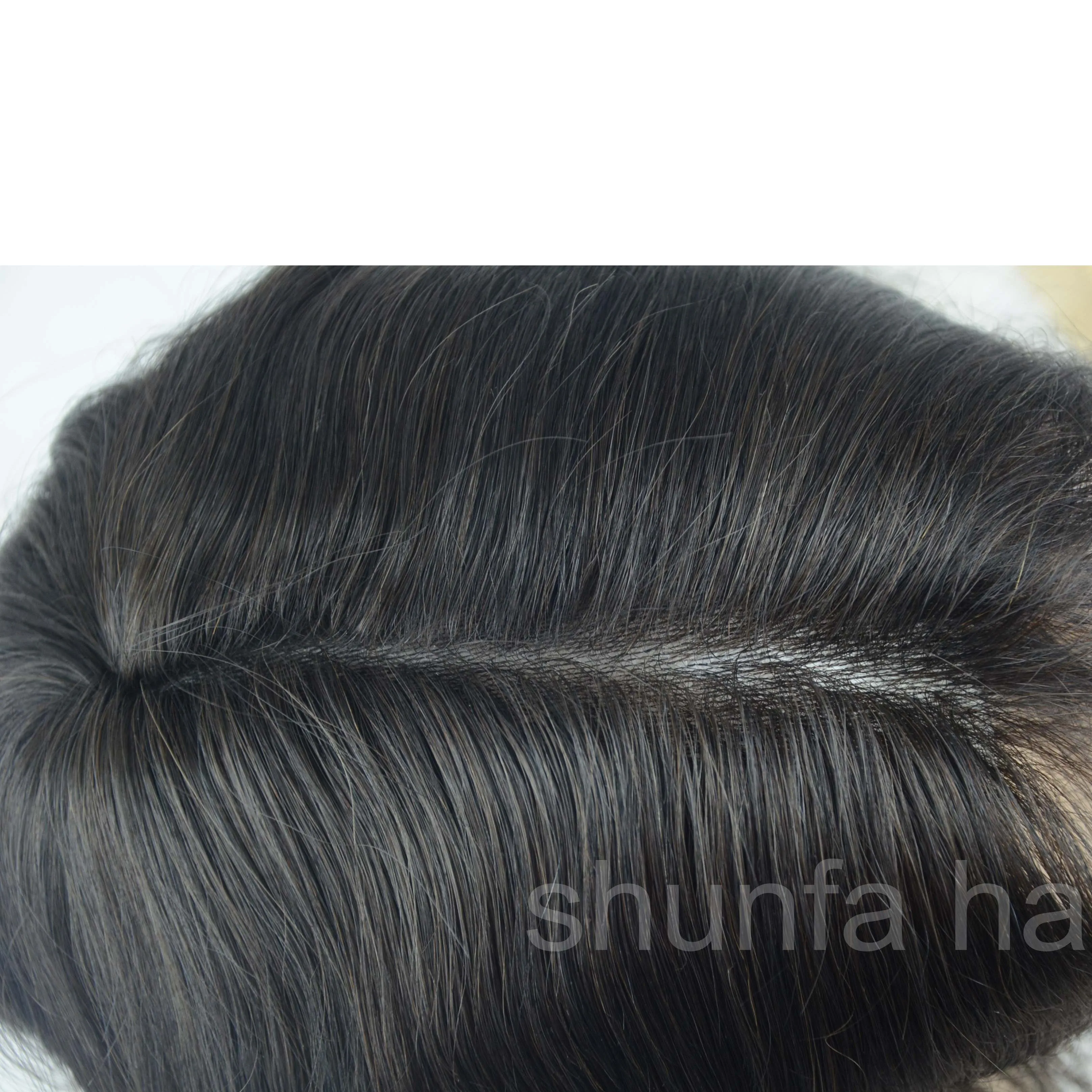 Capillary prosthesis