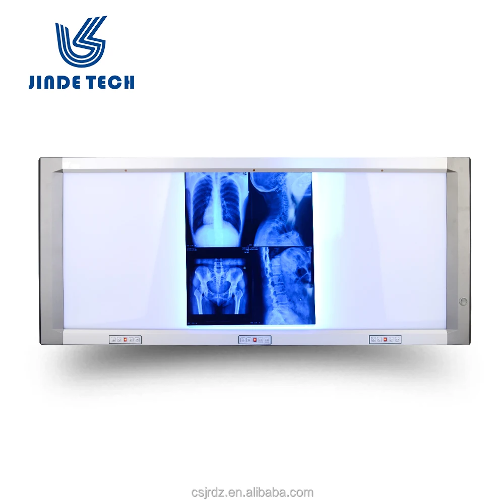 medical x-ray film viewer, good x ray illuminator
