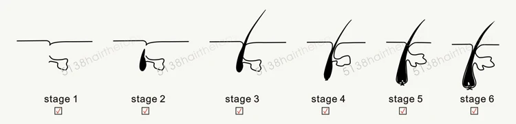 Trending products fue hair transplant equipment scalp massager hair growth equipment