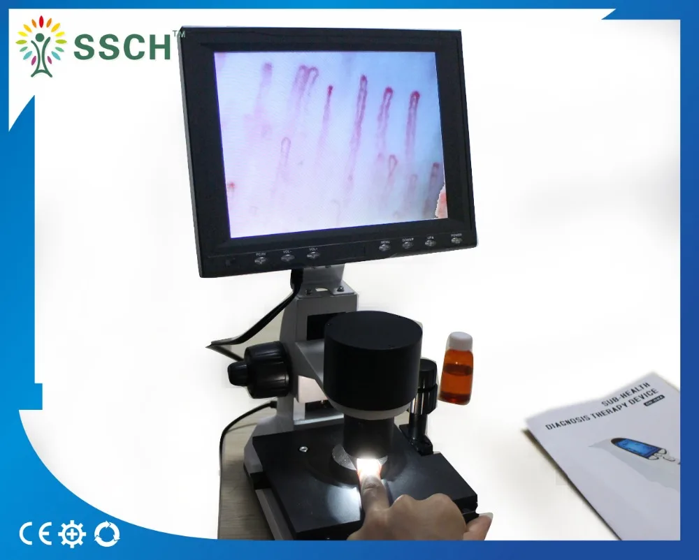 Сертификат CE кровотока nailfold микроциркуляции микроскоп