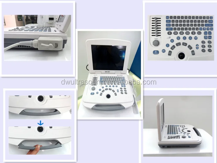 DW-VET2 full digital ultrasound scanner for veterinary/USG scanner instrument with competitive price pet hospital