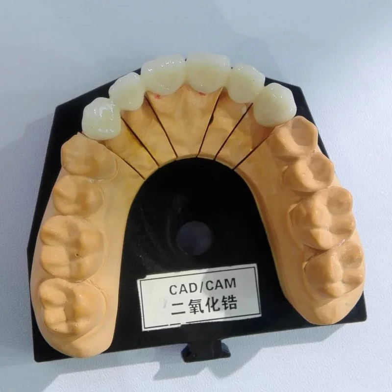 Распродажа стоматологического лабораторного оборудования! Цирконий Корона мост Dental cad cam изготовление зубных протезов 4 оси фрезерный станок с ЧПУ