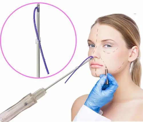 
factory supply thread face lift procedure non-surgical for skin care 