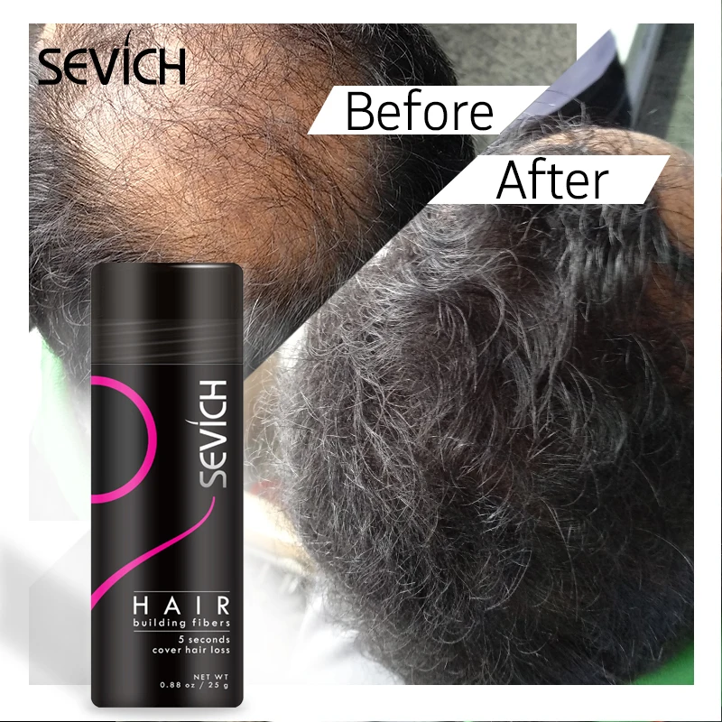 
Best Hair Fibers Instantly Thickens Thinning Hair for Men and Women - Natural Hair Loss Concealer 