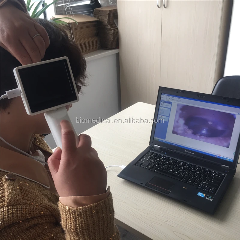 Medical Video Scope Otoscope And ENT Endoscope Rhinoscope Laryngoscope