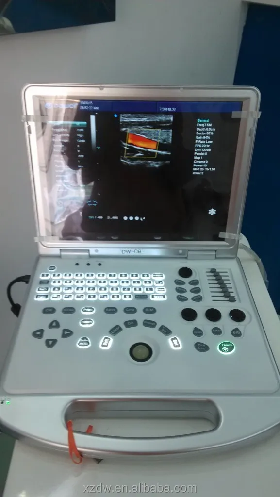 Portable echography machine/ laptop ultrasound scanner/portable echo machine color doppler