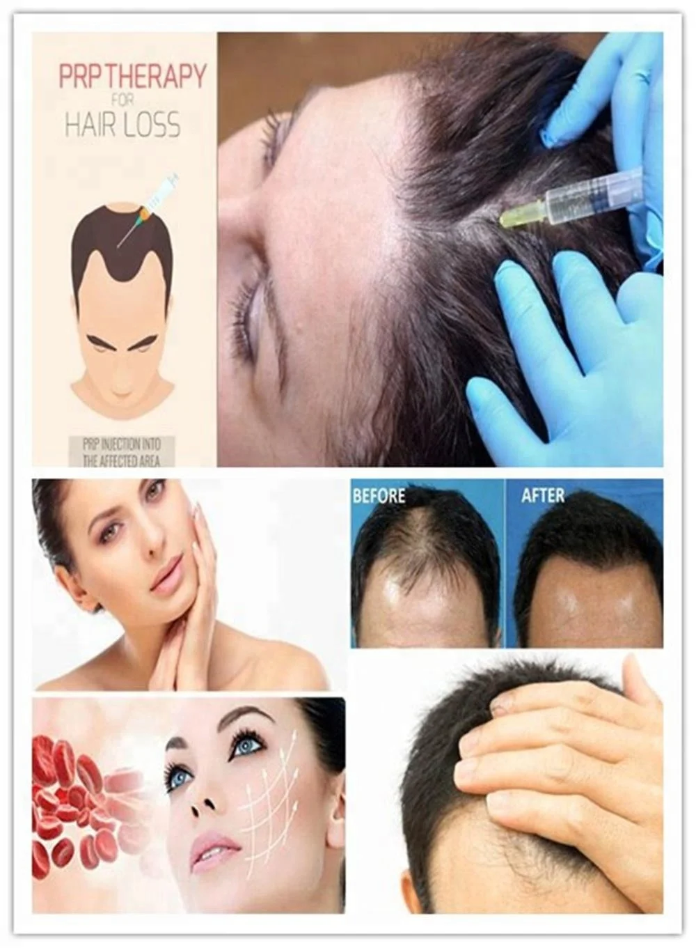 L3-5KM PRP PPP извлечения стволовых клеток разделения самостоятельно жира трансплантата центрифуга для салона красоты пластиковые больницы