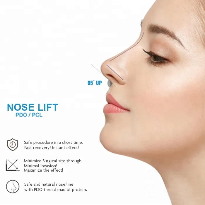 Beautlift pdo nose cog thread nasal lifting tensioning threads 3d