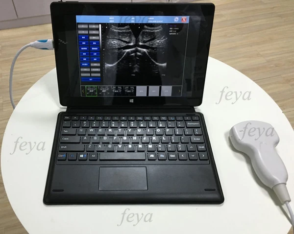 FY-UP-10 IPAD Tablet Mini Ultrasound Scanner