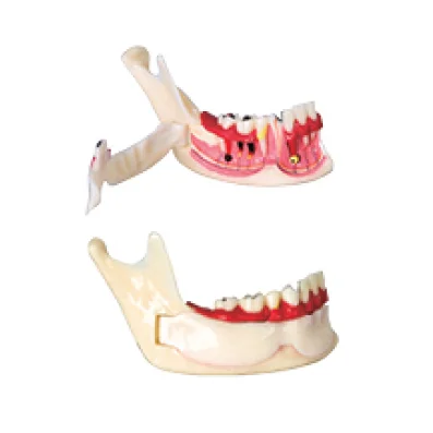 Gelsonlab HSDT-N14 Dental Decomposition Model Organization od Mandible Model