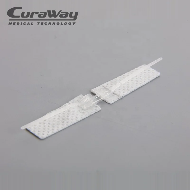 
Disposable Medical Supply Surgical Adhesive Wound Dressing Suture Device 