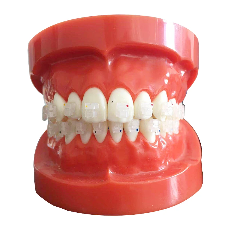 Распродажа стоматологических материалов из нержавеющей стали Ортодонтические металлические скобы CE Roth 022