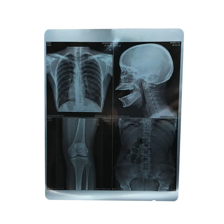 
Medical Radiation Laser Printing Film for Hospital Use 