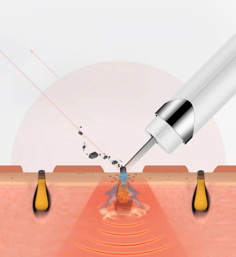 2019 Hot Selling Deep Clean Facial Skin Scraper Electric Ultrasonic Skin Scrubber For Beauty Whitening Facial Machine