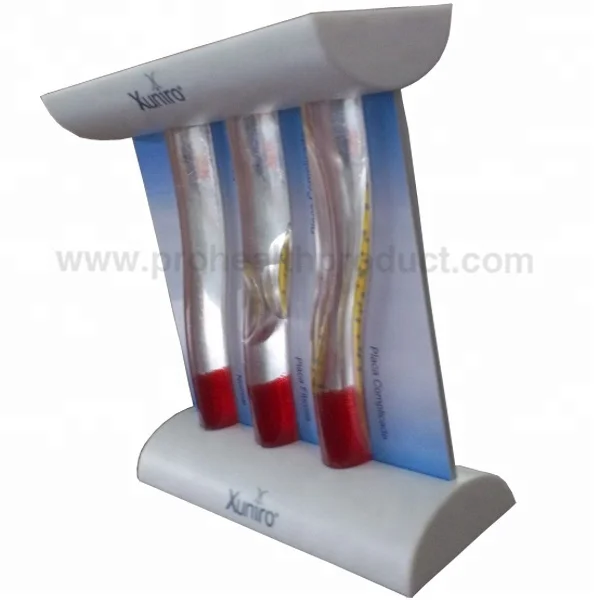 Dynamic vascular Blood Vessel Educational Teaching Model, LDL Low-density Lipoprotein Vascular Disease Model