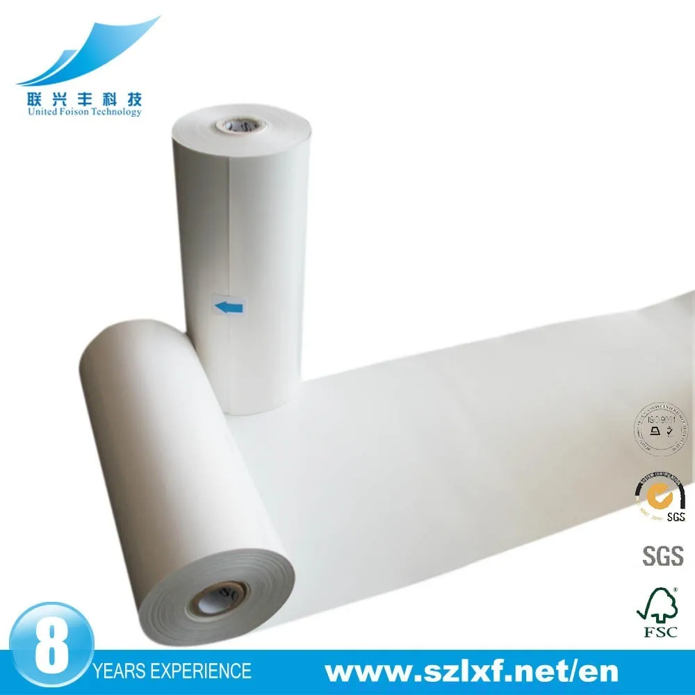 2021 High quality ultrasound thermal paper rolls upp-110s for ultrasound video printer