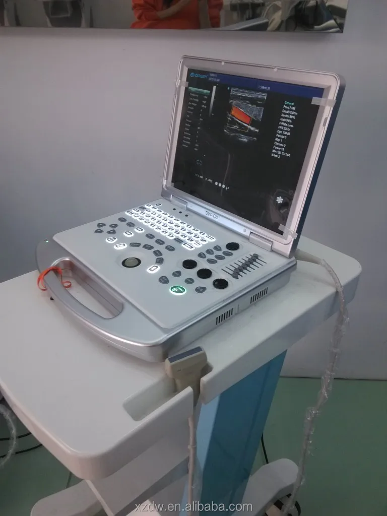 Portable echography machine/ laptop ultrasound scanner/portable echo machine color doppler