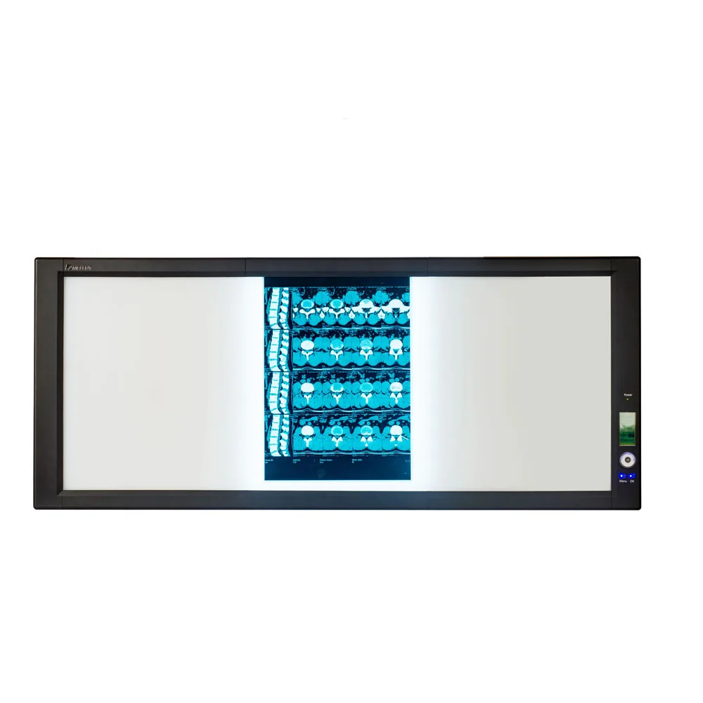 
Best quality Mplent triple bank led xray film viewer box 